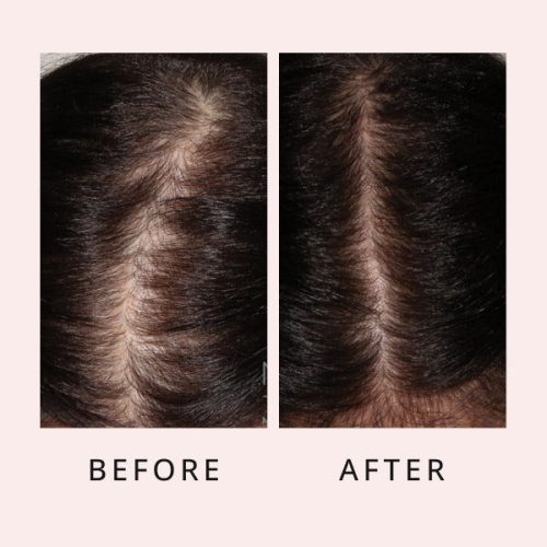 HairGrowthSerum 12