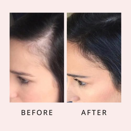 HairGrowthSerum 13