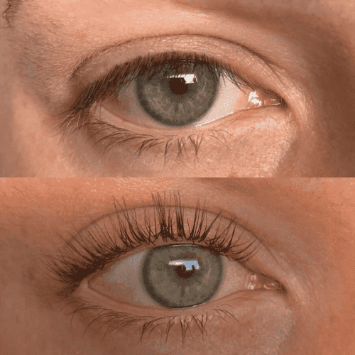 luxe before and after 1 optimized c4001259 7e55 482b 9e92 0dc925cd9759